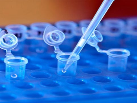 Lab Sample Management